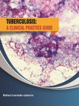 Tuberculosis: A Clinical Practice Guide- Product Image