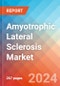 Amyotrophic Lateral Sclerosis (ALS) - Market Insight, Epidemiology and Market Forecast - 2034 - Product Image