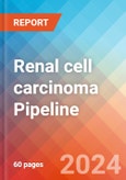 Renal cell carcinoma - Pipeline Insight, 2024- Product Image