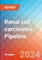 Renal cell carcinoma - Pipeline Insight, 2024 - Product Image