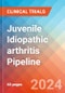 Juvenile Idiopathic arthritis (JIA) - Pipeline Insight, 2024 - Product Image