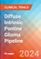 Diffuse Intrinsic Pontine Glioma - Pipeline Insight, 2024 - Product Image