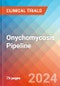 Onychomycosis - Pipeline Insight, 2024 - Product Image