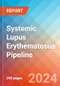 Systemic Lupus Erythematosus - Pipeline Insight, 2024 - Product Thumbnail Image