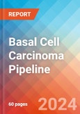 Basal Cell Carcinoma (Basal Cell Epithelioma) - Pipeline Insight, 2024- Product Image