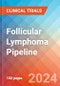 Follicular Lymphoma - Pipeline Insight, 2024 - Product Thumbnail Image