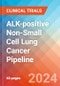ALK-positive Non-Small Cell Lung Cancer (ALK+ NSCLC) - Pipeline Insight, 2024 - Product Image