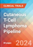 Cutaneous T-Cell Lymphoma (CTCL) - Pipeline Insight, 2024- Product Image