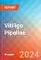 Vitiligo - Pipeline Insight, 2024 - Product Image