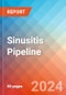 Sinusitis - Pipeline Insight, 2024 - Product Image