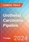 Urothelial Carcinoma - Pipeline Insight, 2024 - Product Image