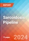 Sarcoidosis - Pipeline Insight, 2024 - Product Thumbnail Image