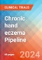 Chronic hand eczema - Pipeline Insight, 2024 - Product Image