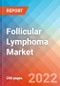 Follicular Lymphoma - Market Insight, Epidemiology and Market Forecast -2032 - Product Thumbnail Image