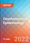 Onychomycosis - Epidemiology Forecast - 2032 - Product Thumbnail Image