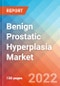 Benign Prostatic Hyperplasia- Market Insight, Competitive Landscape and Market Forecast, 2027 - Product Thumbnail Image