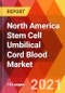 North America Stem Cell Umbilical Cord Blood Market, By Storage Services (Private, Public, Hybrid), By Therapeutics (Diabetes, Blood Diseases, Immune Disorders, Others), By Application (Transplant, Regenerative), Estimation & Forecast, 2017 - 2027 - Product Thumbnail Image