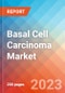 Basal Cell Carcinoma (Basal Cell Epithelioma) - Market Insight, Epidemiology and Market Forecast - 2032 - Product Image