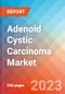 Adenoid Cystic Carcinoma - Market Insight, Epidemiology and Market Forecast - 2032 - Product Image