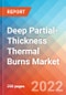 Deep Partial-Thickness Thermal Burns - Market Insight, Epidemiology and Market Forecast -2032 - Product Thumbnail Image