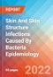 Skin And Skin Structure Infections (SSSI) Caused By Bacteria - Epidemiology Forecast to 2032 - Product Thumbnail Image