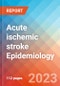 Acute ischemic stroke (AIS) - Epidemiology Forecast - 2032 - Product Thumbnail Image