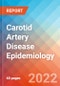 Carotid Artery Disease - Epidemiology Forecast - 2032 - Product Thumbnail Image