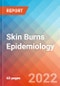 Skin Burns - Epidemiology Forecast to 2032 - Product Thumbnail Image