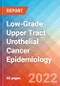 Low-Grade Upper Tract Urothelial Cancer (LG UTUC) - Epidemiology Forecast to 2032 - Product Thumbnail Image