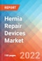 Hernia Repair Devices Market Insights, Competitive Landscape and Market Forecast-2027 - Product Thumbnail Image
