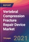 Vertebral Compression Fracture Repair Device Market Size, Market Share, Application Analysis, Regional Outlook, Growth Trends, Key Players, Competitive Strategies and Forecasts, 2021 to 2029 - Product Thumbnail Image