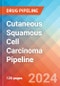 Cutaneous Squamous Cell Carcinoma - Pipeline Insight, 2024 - Product Image