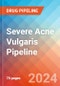Severe Acne Vulgaris - Pipeline Insight, 2024 - Product Image