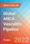 Global ANCA Vasculitis - Pipeline Insight, 2022 - Product Thumbnail Image