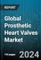 Global Prosthetic Heart Valves Market by Product (Mitral Valve Repair Devices, Repair Product, Tricuspid Valve Repair Devices), Type of Valve (Biological/Tissue Heart Valve, Mechanical Heart Valve, Transcatheter Heart Valve), End User - Forecast 2024-2030 - Product Image