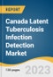 Canada Latent Tuberculosis Infection Detection Market Size, Share & Trends Analysis Report By Test Type (Tuberculin Skin Test, Interferon Gamma Release Assays), By End-use, By Province, And Segment Forecasts, 2023-2030 - Product Thumbnail Image