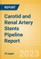 Carotid and Renal Artery Stents Pipeline Report including Stages of Development, Segments, Region and Countries, Regulatory Path and Key Companies, 2023 Update - Product Image