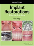 Implant Restorations. A Step-by-Step Guide. Edition No. 4- Product Image
