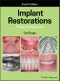 Implant Restorations. A Step-by-Step Guide. Edition No. 4 - Product Image