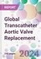 Global Transcatheter Aortic Valve Replacement Market Analysis & Forecast to 2024-2034 - Product Image