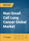 Non-Small Cell Lung Cancer (NSCLC) Global Market Report 2024 - Product Image