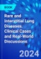 Rare and Interstitial Lung Diseases. Clinical Cases and Real-World Discussions - Product Image