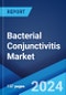 Bacterial Conjunctivitis Market: Epidemiology, Industry Trends, Share, Size, Growth, Opportunity, and Forecast 2024-2034 - Product Thumbnail Image