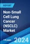 Non-Small Cell Lung Cancer (NSCLC) Market: Epidemiology, Industry Trends, Share, Size, Growth, Opportunity and Forecast 2024-2034 - Product Thumbnail Image