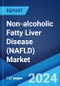 Non-alcoholic Fatty Liver Disease (NAFLD) Market: Epidemiology, Industry Trends, Share, Size, Growth, Opportunity and Forecast 2024-2034 - Product Thumbnail Image