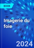 Imagerie du foie- Product Image