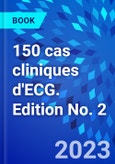 150 cas cliniques d'ECG. Edition No. 2- Product Image