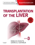 Transplantation of the Liver. Edition No. 3- Product Image