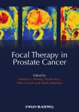 Focal Therapy in Prostate Cancer. Edition No. 1- Product Image