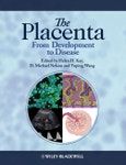 The Placenta. From Development to Disease. Edition No. 1- Product Image